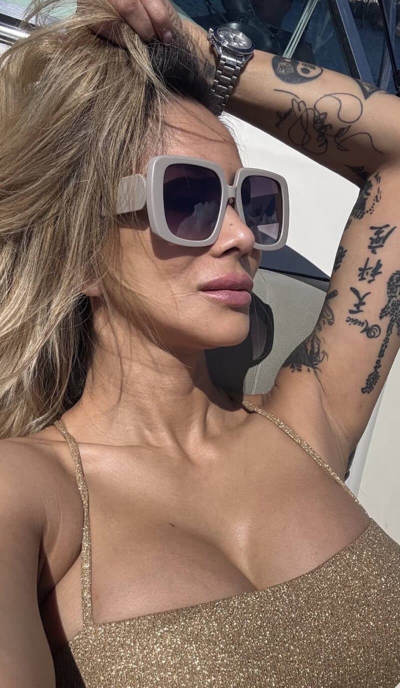 Facelift in Houston Texas