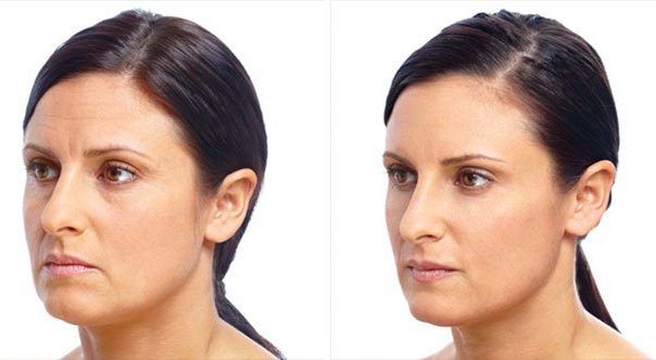 Three Top Face Surgery Procedures