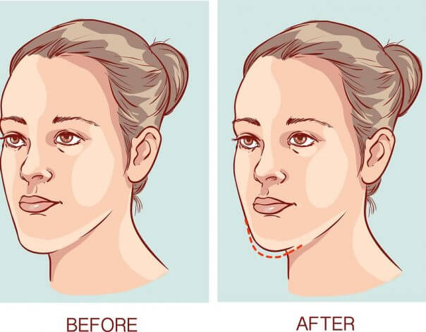 My Chin Is Too Long!