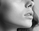 Chin Implant